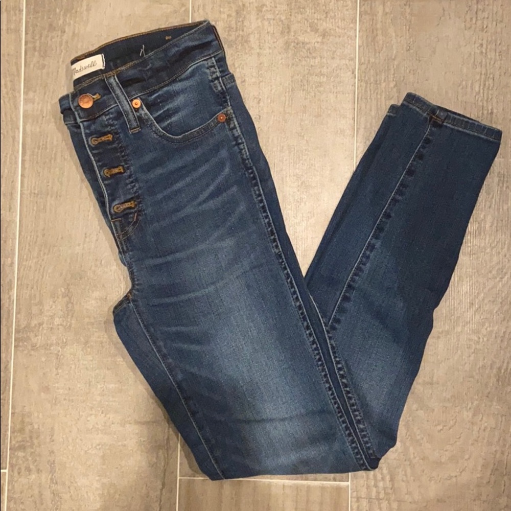 Madewell 10 inch high rise skinny button fly
